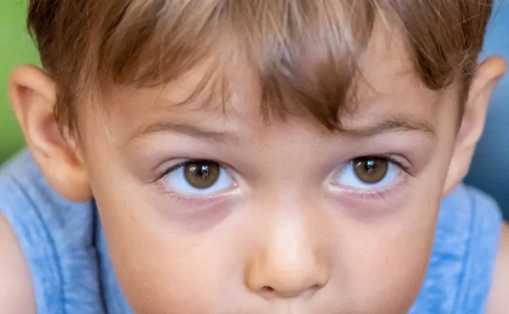 Dark Eye Bags Blog 1024x633 1
